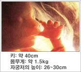 태아의 특징 - 키 : 약 40cm, 몸무게 : 약 1.5kg, 자궁의 크기 : 약 26~30cm